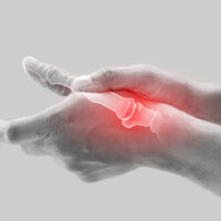 ssd for arthritis ssd for arthritis
